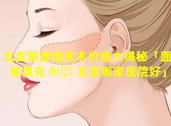 北京额部填充术价格大揭秘「面部填充 🦁 北京哪家医院好」